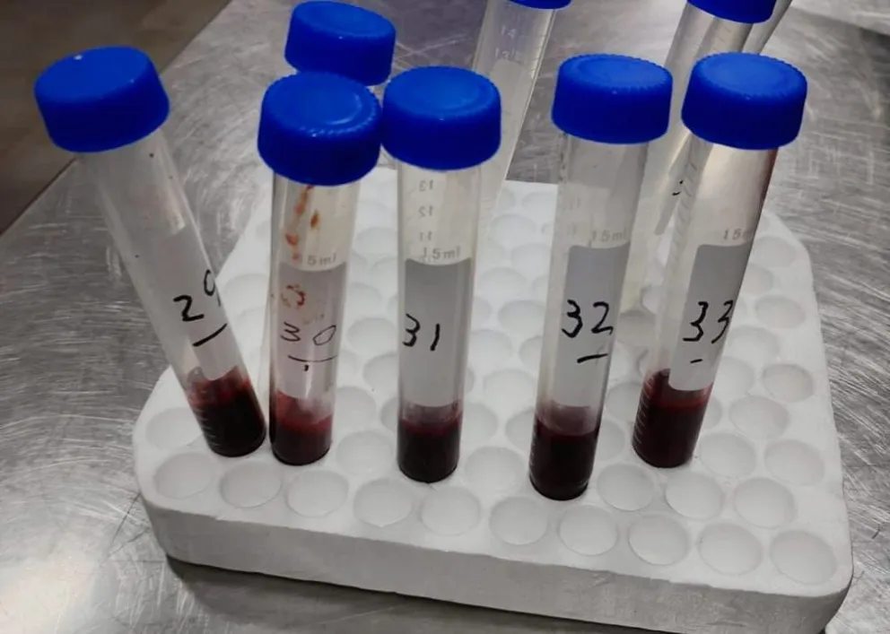 El último estudio similar fue realizado en 1992. Foto: Municipalidad de Bariloche.