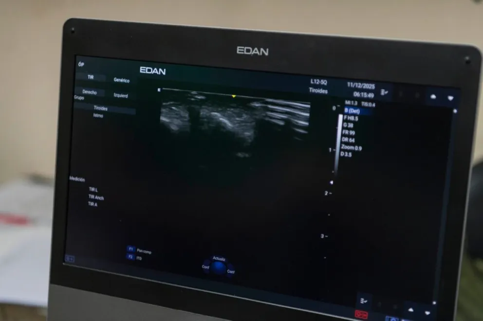 Nuevos ecógrafos de alta complejidad fortalecen la atención en los hospitales rionegrinos. Foto gentileza