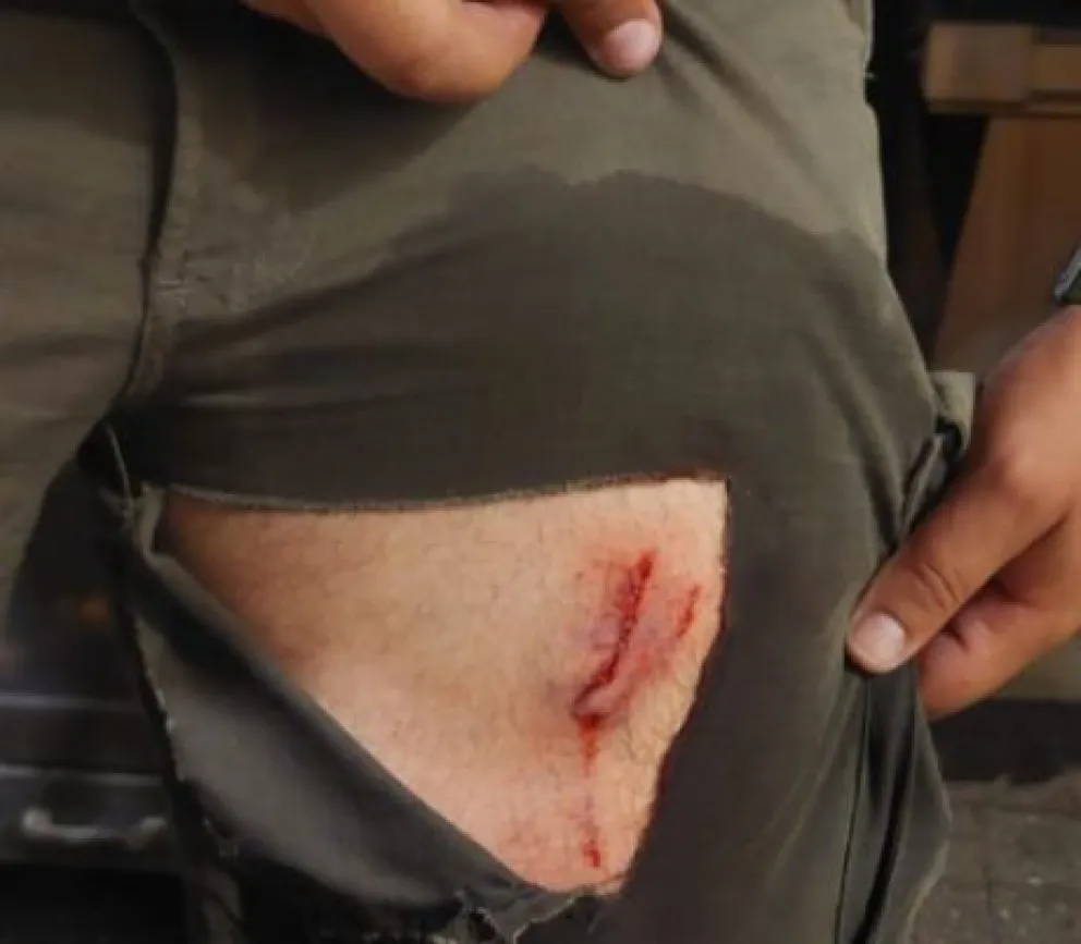 El guardaparque recibió asistencia médica inmediata tras el ataque. Foto gentileza 