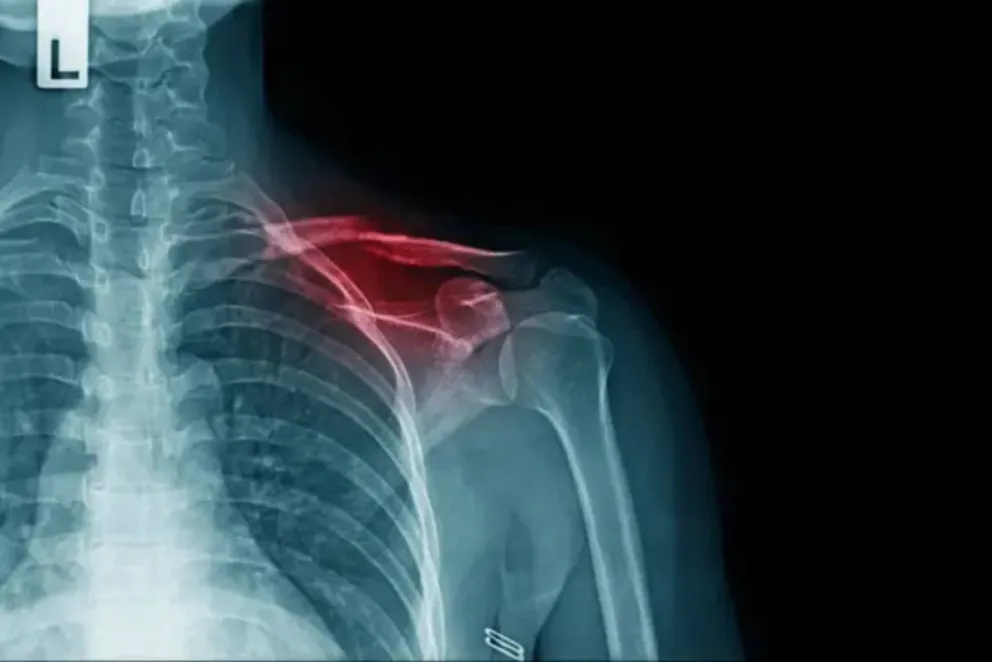 La mujer sufrió una caída en moto.