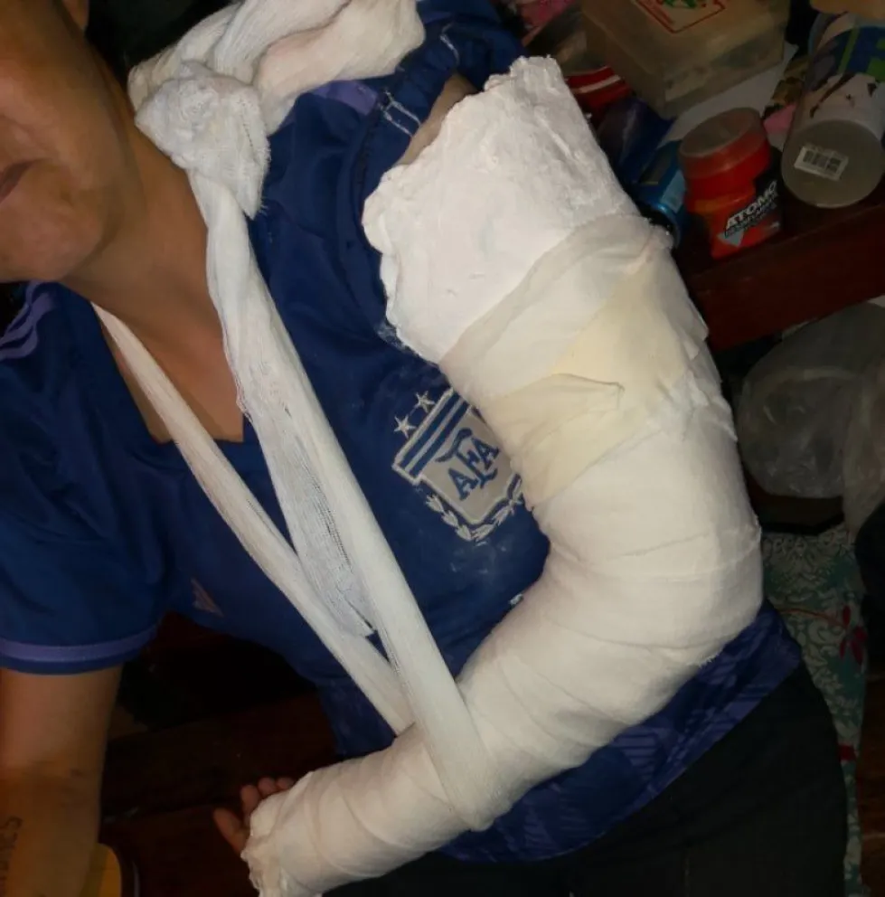 La mujer mayor sufrió una fractura de codo y deberá ser intervenida quirúrgicamente. Foto facebook