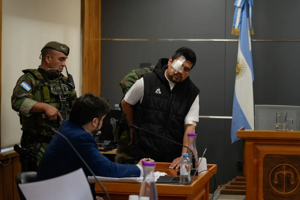 Franco Alí González se encuentra detenido en el hospital zonal por haber recibido un disparo en el rostro. Foto: Marcelo Martínez 