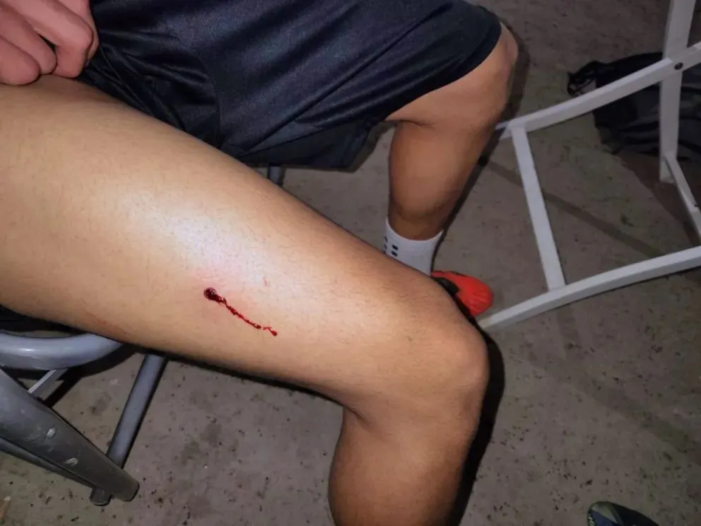Joven herido. (Foto Gentileza)